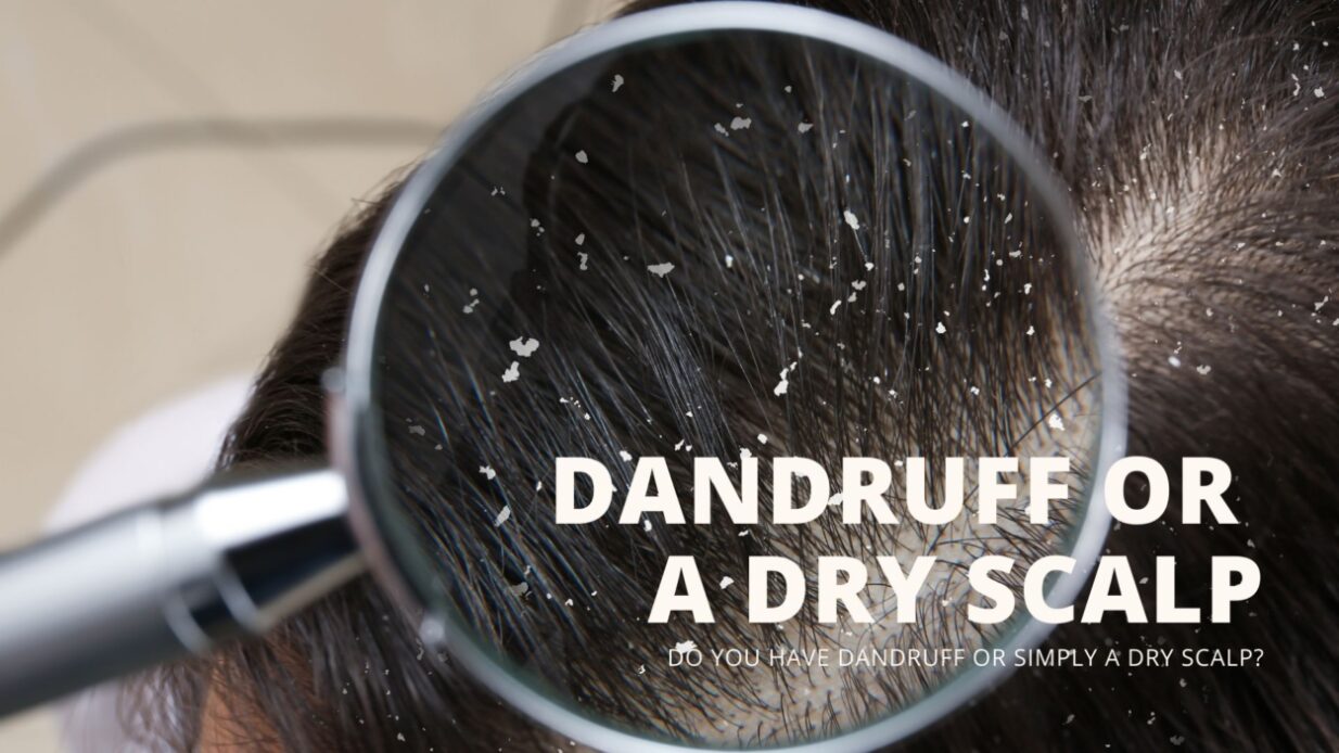 Dandruff or Dry Scalp?