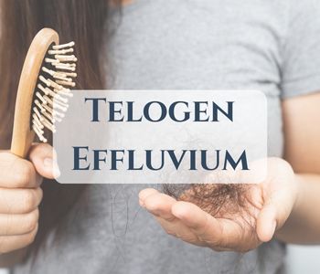 Telogen Effluvium