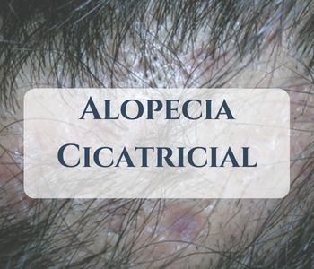 Alopecia cicatricia
