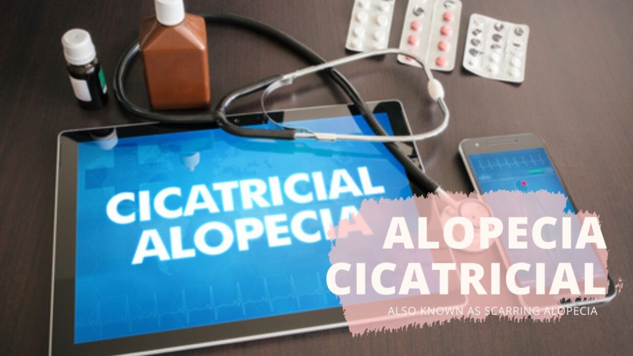 Alopecia Cicatricial