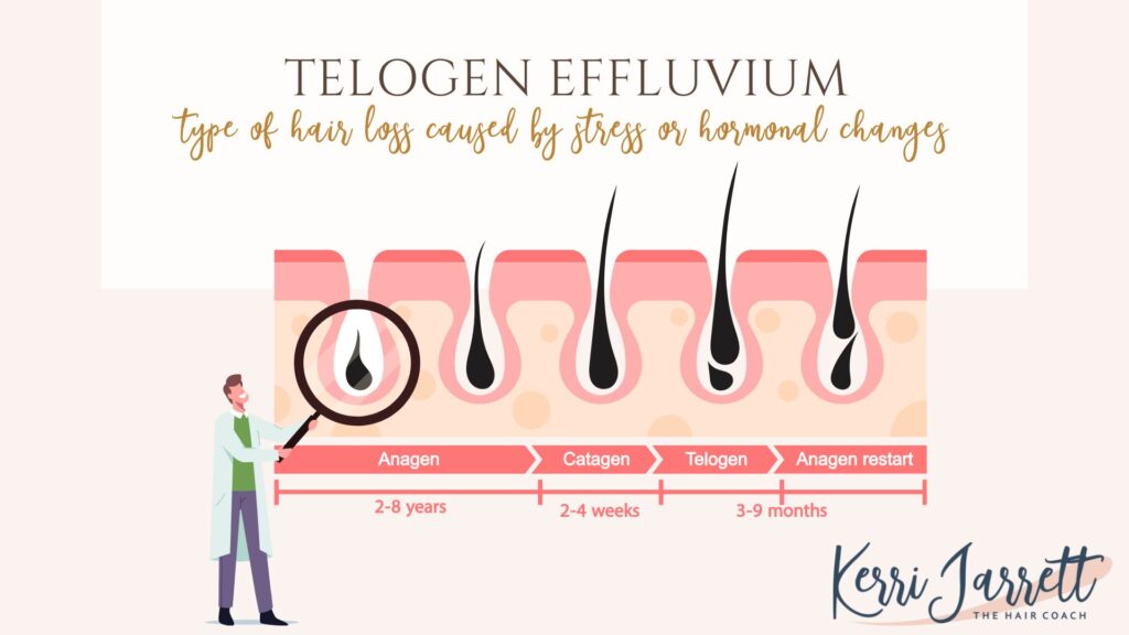 Telogen Effluvium
