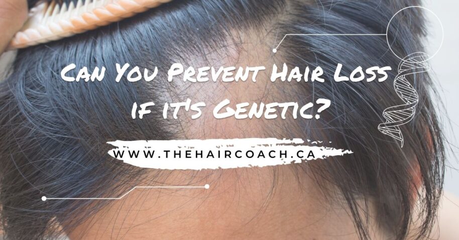Can You Prevent Hair Loss if it's Genetic?